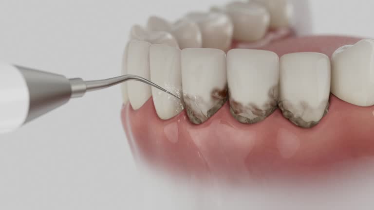 Reliable Dental Implants contractor in Gervais, OR by Smile Center Dentistry